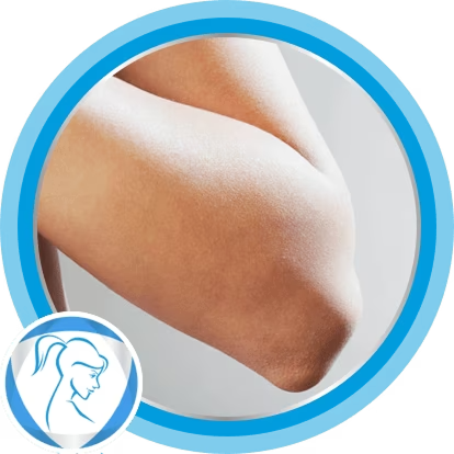 Skin irritations in adults homepage img