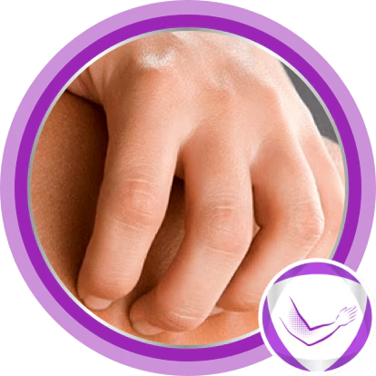Atopic eczema homepage img